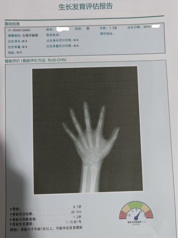 骨龄和身高有什么关系？每个孩子都有必要检测吗？